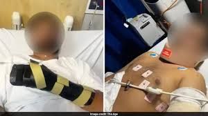 News Photo 1 - Australia - Otta Nottathil - australia_indian_racial_attack
